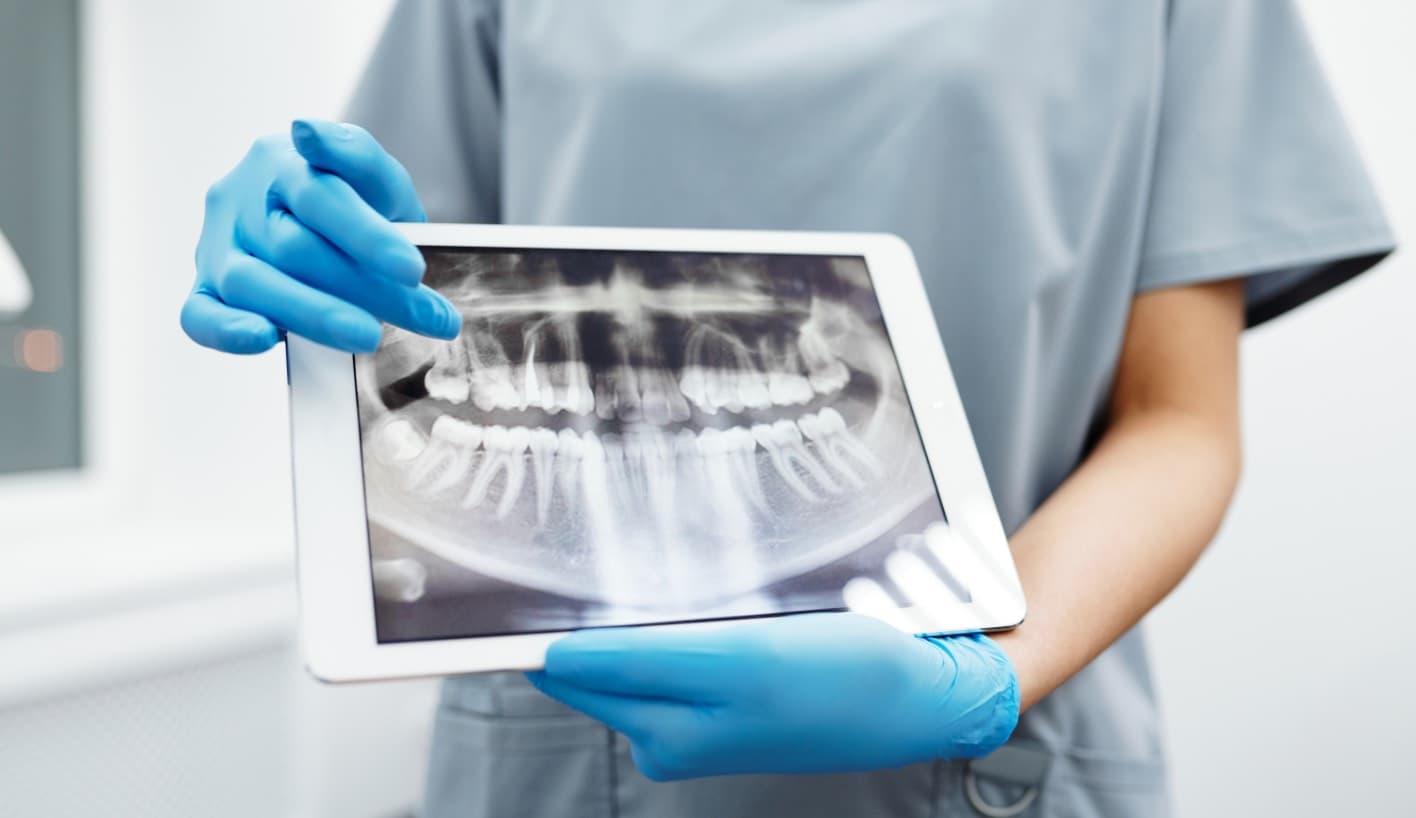 Close-up of a dental implant restoration